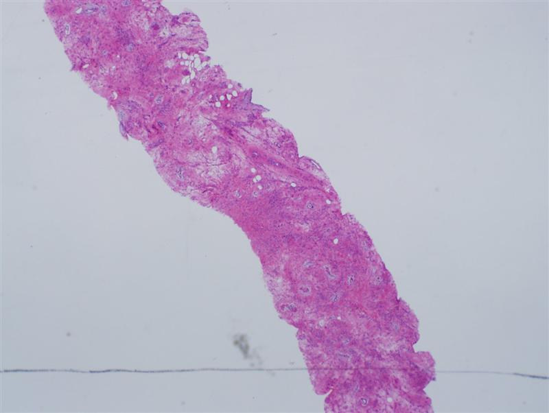 Pathology Image
